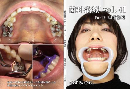 歯科治療　vol.41　part2