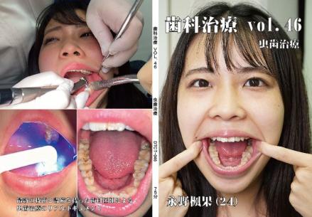 歯科治療　Vol.46